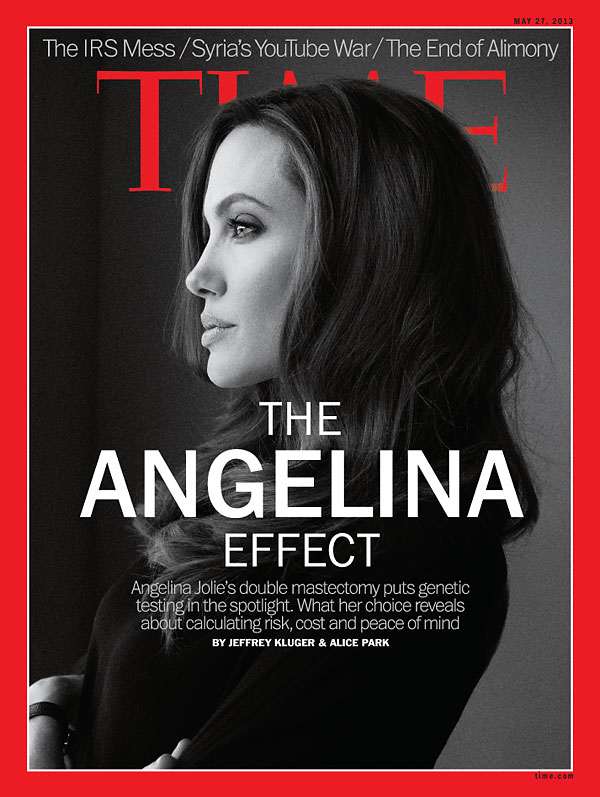 El efecto Angelina: de tanto miedo a moririse se amputa órganos por las dudas