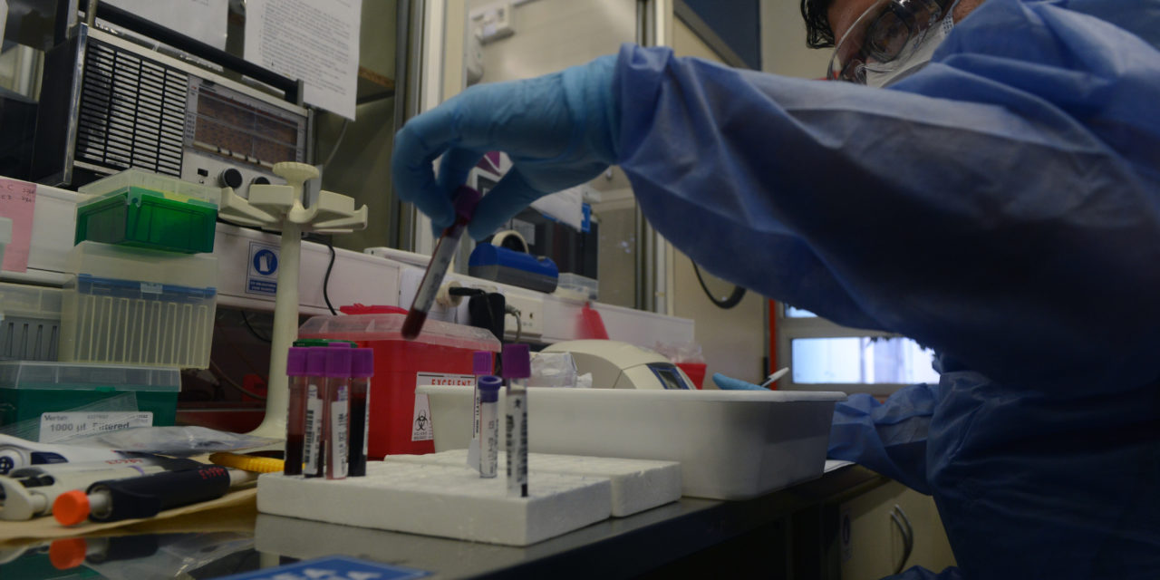 Coronavirus: Los test sin analizar ya superan los 50 mil en el AMBA