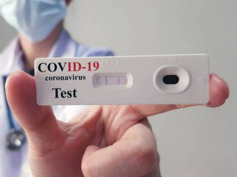 Coronavirus: comienzan a vender los autotest en las farmacias