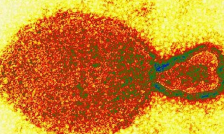 Brote de Henipavirus: qué es y cuáles son los síntomas