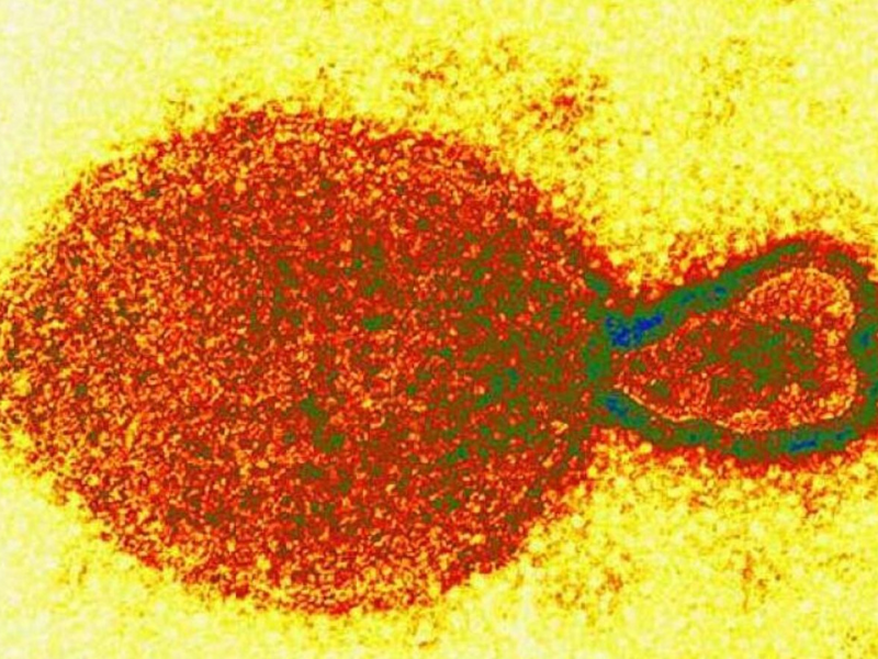 Brote de Henipavirus: qué es y cuáles son los síntomas