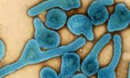 El virus de Marburgo: la enfermedad que atemoriza a la OMS