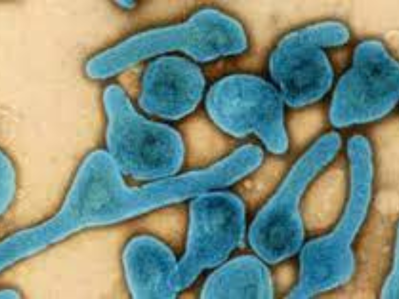 El virus de Marburgo: la enfermedad que atemoriza a la OMS