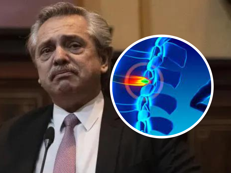 La salud de Alberto Fernández: Qué es la hernia de disco y qué tratamiento le harán